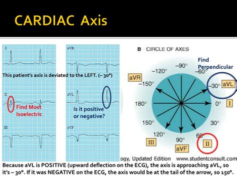 Image result for ECG Machine Tutorial
