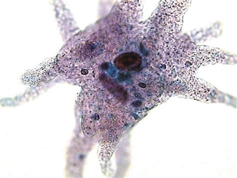 Image result for Bacteria Microscope Slides