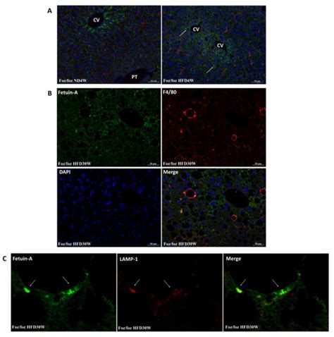 Fetuin-A in Activated Liver Macrophages Is a Key Feature of Non ...