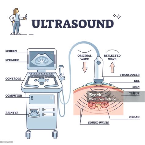 Schéma Dexplication Du Processus Danalyse Des Patients Par Ultrasons Et De Léquipement Vecteurs ...