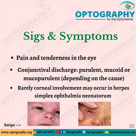 Ophthalmia Neonatorum