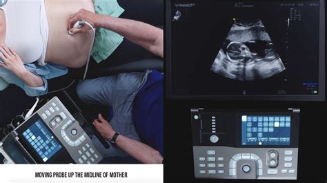 Is Ultrasound Better Than X-Ray? Understanding the Differences and When Each Matters - Portable ...
