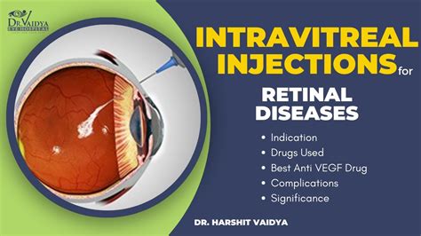 Image result for IVT Injection