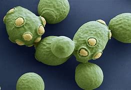 Saccharomyces cerevisiae 的图像结果