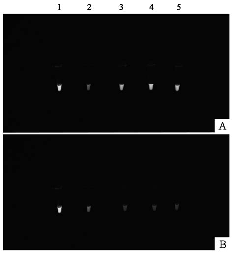 Development and Evaluation of Loop-Mediated Isothermal Amplification ...