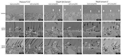 Micromorphology of the Adhesive Interface of Self-Adhesive Resin ...