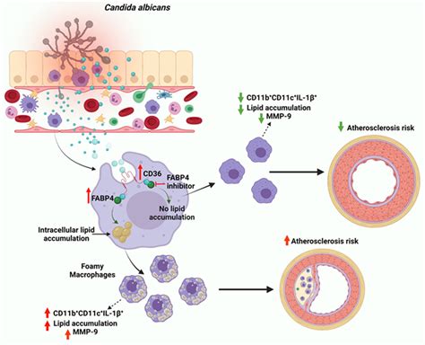 Candida albicans Induces Foaming and Inflammation in Macrophages ...