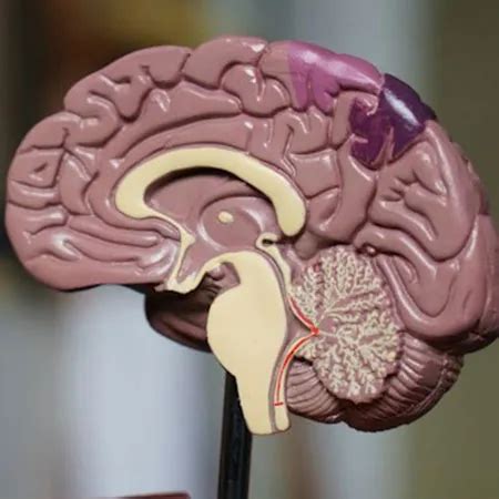 Best Neurology - Brain Specialists in Hyderabad, Top Neurology - Brain ...