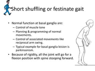 Miami Step Tutorial Shuffling 的图像结果