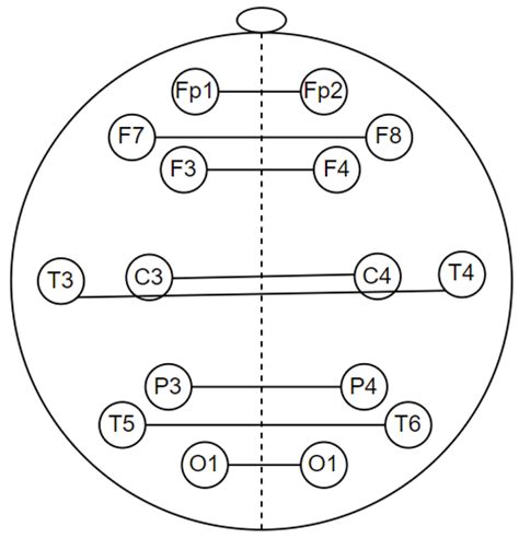 Multi Modal Feature Extraction for Classification of Vascular Dementia ...