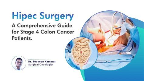 Image result for HIPEC Surgery for Appendix Cancer