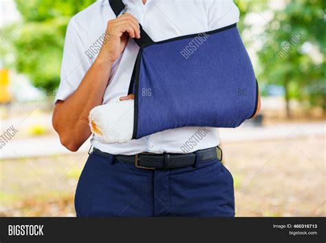 Man Broken Arm Cast. Image & Photo (Free Trial) | Bigstock