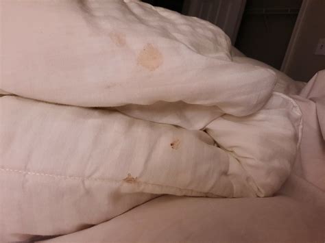 RESIDENCE INN BY MARRIOTT SEATTLE BELLEVUE - Hotel Reviews, Photos ...