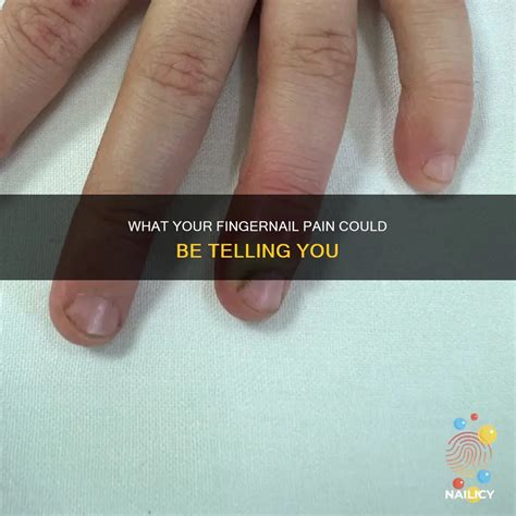 What Your Fingernail Pain Could Be Telling You | Nailicy