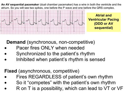 Image result for Heart Rhythm Monitoring Algorithm