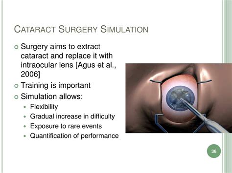Image result for Eye Surgery Simulation