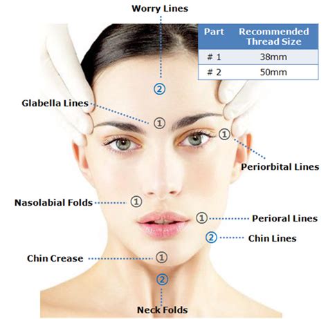 Thread Face Lift – Dermacare Skin & Laser Centre