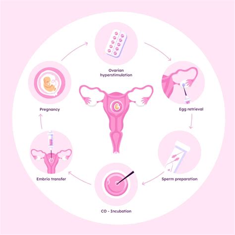 What Are the 5 Stages of IVF - Know The Process