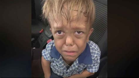 Mother Posts Heartbreaking Video Of Son With Dwarfism Sobbing After ...