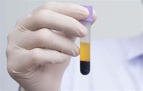 Biochemistry Cat Sample 的图像结果