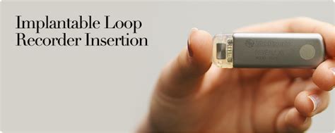 Removing a Loop Recorder 的图像结果