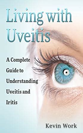 Living with Uveitis: A Complete Guide to Uveitis and Iritis eBook ...