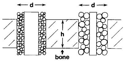 Image result for Particle Size Comparison Chart