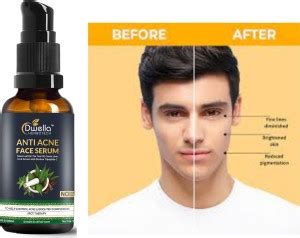 DWELLA HERBOTECH Anti Acne Face Serum Natural Neem Leaf Oil, No ...