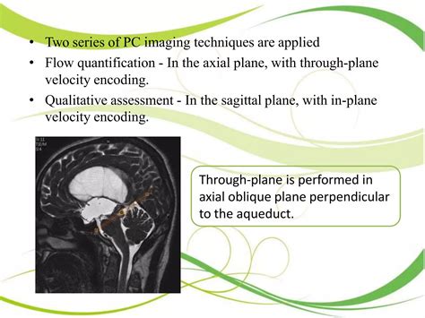 Normal CSF Flow On MRI 的图像结果
