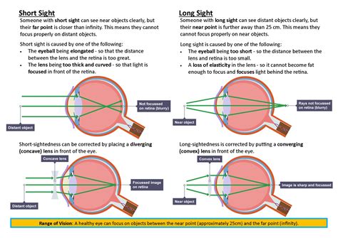 GCSE Physics Long Sight & Short Sight Poster | Teaching Resources