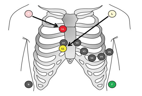 Image result for Lead Optimization Mapper Algorithm