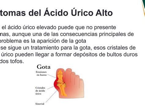acido urico de bioquimica II.pptx | Chemistry | Science