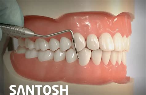 Best MDS Periodontology Courses/Programs in Ghaziabad