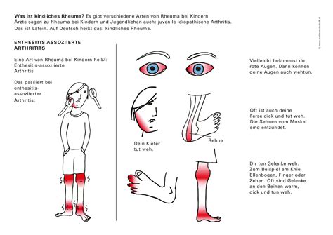 Enthesitis assoziierte Arthritis