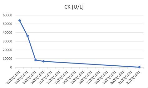 Image result for CK Ink Levels