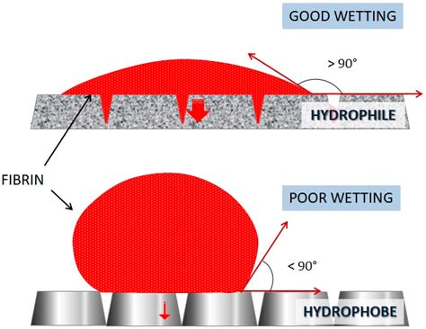 Surface Coatings of Dental Implants: A Review