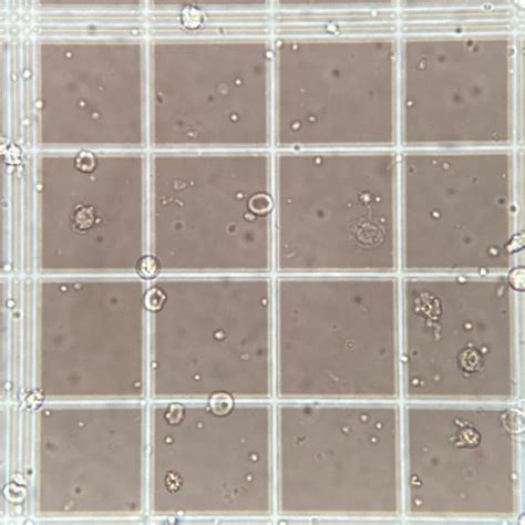 Image result for Cell Image Object Detection Python Code