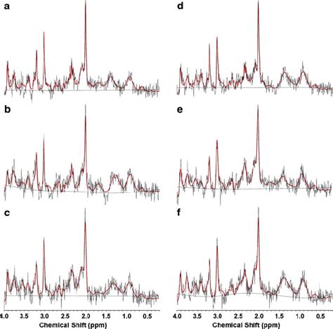 Image result for Contralateral Hemisphere