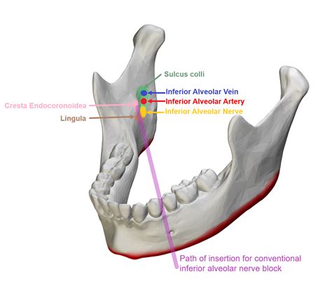 Inferior Alveolar Nerve Block Inferior Alveolar Nerve - vrogue.co