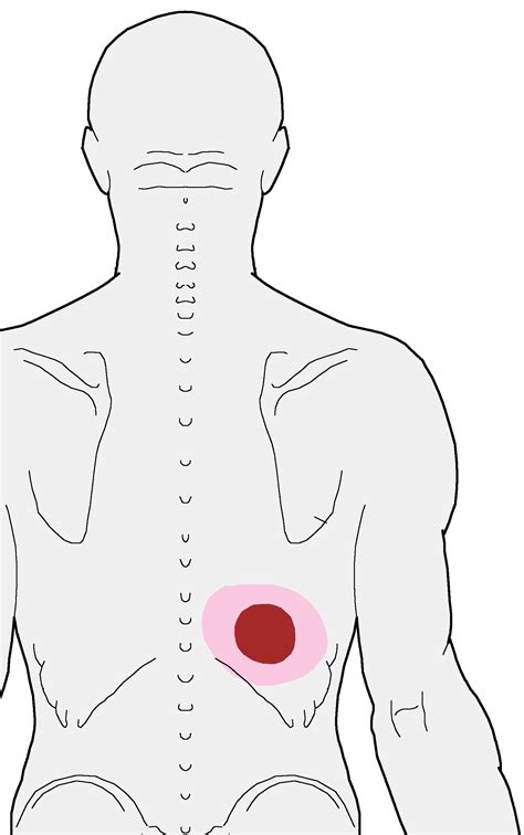 Trigger Points – Aching and Burning in the mid back | | Integrative Works | Mid back pain ...