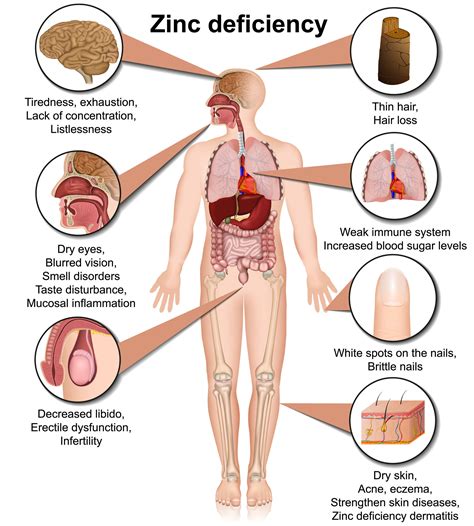 Causes Of Zinc Deficiency