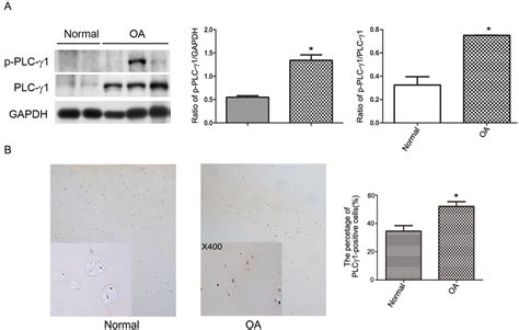 IJMS | Special Issue : The Chondrocyte Phenotype in Cartilage Biology