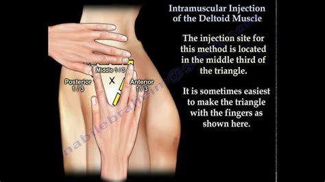 Intramuscular Injection Sites Thigh