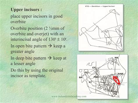 Image result for Vto Core Target