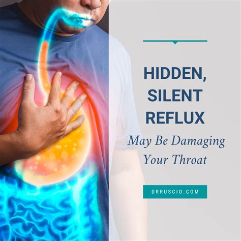 What Is Silent Reflux: Causes, Symptoms Treatment | atelier-yuwa.ciao.jp