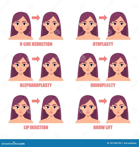 Types Of Plastic Surgery On Face