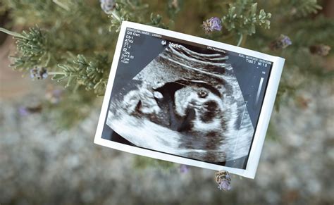 Controversy Erupts As US Startup Offers Opportunity To 'Genetically ...