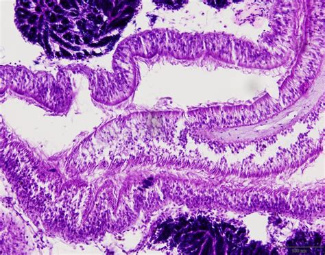 Image result for Tissue Sample Drawing Under Microscope