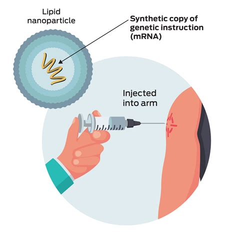 How coronavirus vaccines work