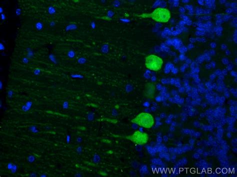 Calbindin-D28k antibody (CL488-66394) | Proteintech